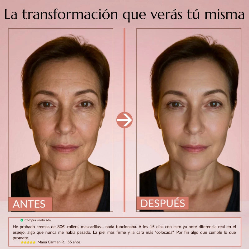 Acaba con tus Complejos: Siéntete Joven, sin Agujas — SkinDerm™